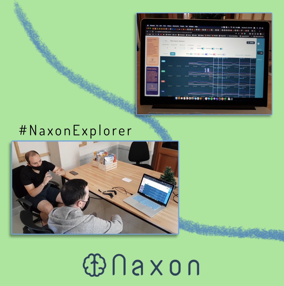 naxonlabs's tweet image. ✨This is your opportunity to research the brain. Record and analyze #braindata with #NaxonExplorer.✨

#naxon #naxontech #eeg #neurotech #bci #wearable #biosensor #neuroscience #brain #neurofeedback #portable #cognition