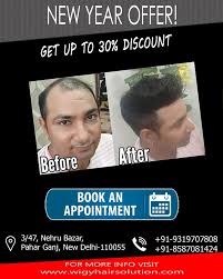 Wigy Hair Solution (@WigyHair) / Twitter Wigy Hair Solution (@WigyHair) / Twitter
