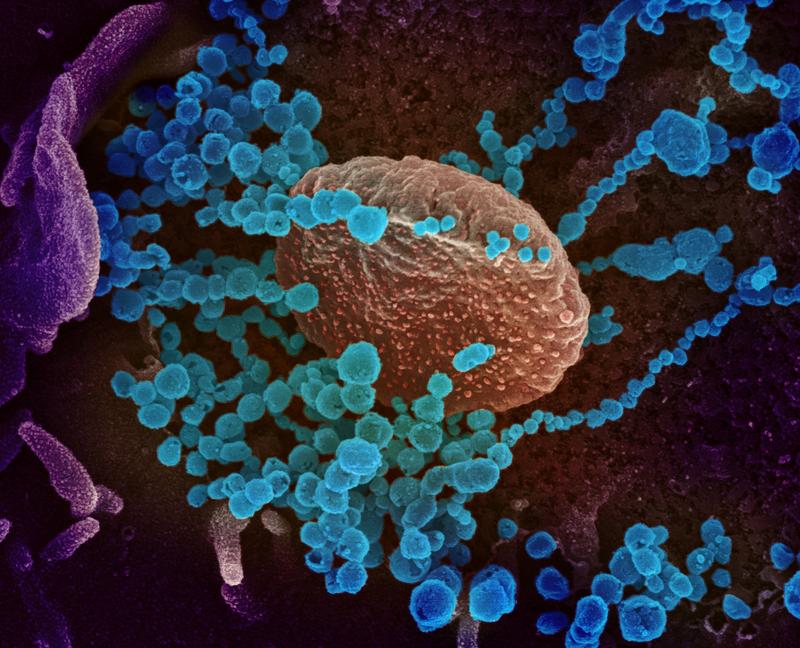 Reuters's tweet photo. New COVID-19 strain spreads more quickly, UK medical chief says https://t.co/P78uX3o6SW https://t.co/FXUUQudsOl