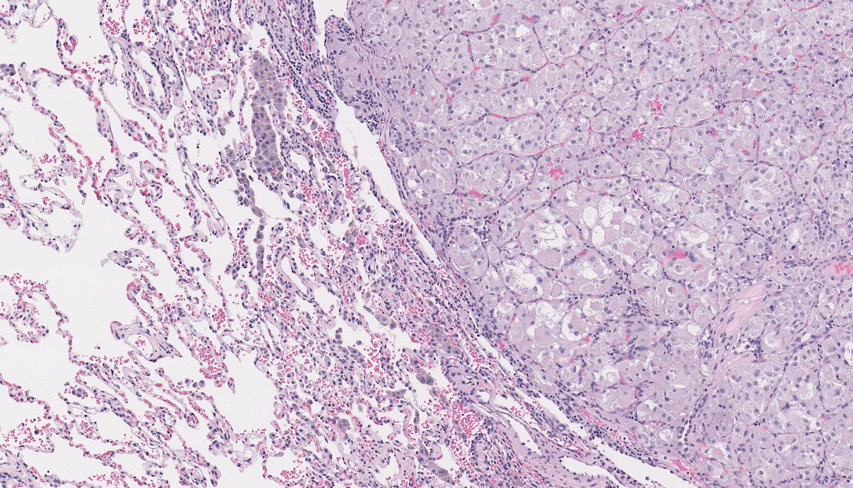 Brendan Dickson, MD tweet media