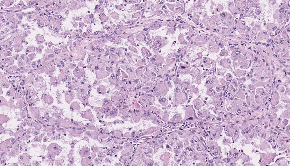 Brendan Dickson, MD tweet media