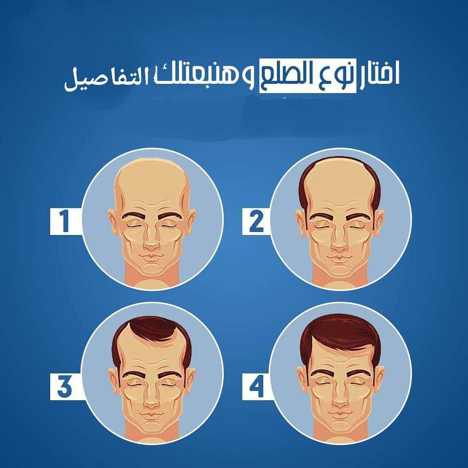DenaSayed10's tweet image. جده#الرياض#عمان#مسقط#البحرين#الااردن#دبي#شعر#صلع#بشره