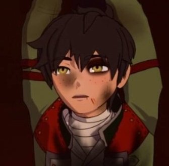 In all seriousness, I highly doubt he doesn't have any broken bones.I mean, look at his face: a black eye, what I'm assuming to be bruises under his eye and jaw (but he was def hit there), a bloody nose, bleeding from the mouth, swelling?, etc.