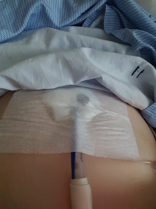 Why I've been #mia: in Nov life slowed to a halt due to fluid around my heart. A #paracardialdrain was<a href="/tag/mia"class="tags">#mia</a><a href="/tag/thursday"class="tags"><span>#thursday</span></a><a href="/tag/paracardialdrain"class="tags"><span>#paracardialdrain</span></a>