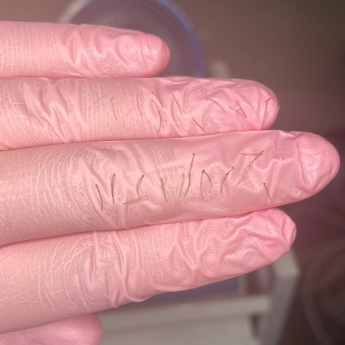 electrolysisllc's tweet photo. When the follicle is destroyed and you know that hair will never grow back again 👌🏼 #callme #electrolysis #electrologist #electrology #itworks #beauty #beautiful #skincare #hair #smile #thankful #happy #thankyou #realresults #frisco #texas #hairremoval  #permanenthairremoval https://t.co/KNWXoBtkSa