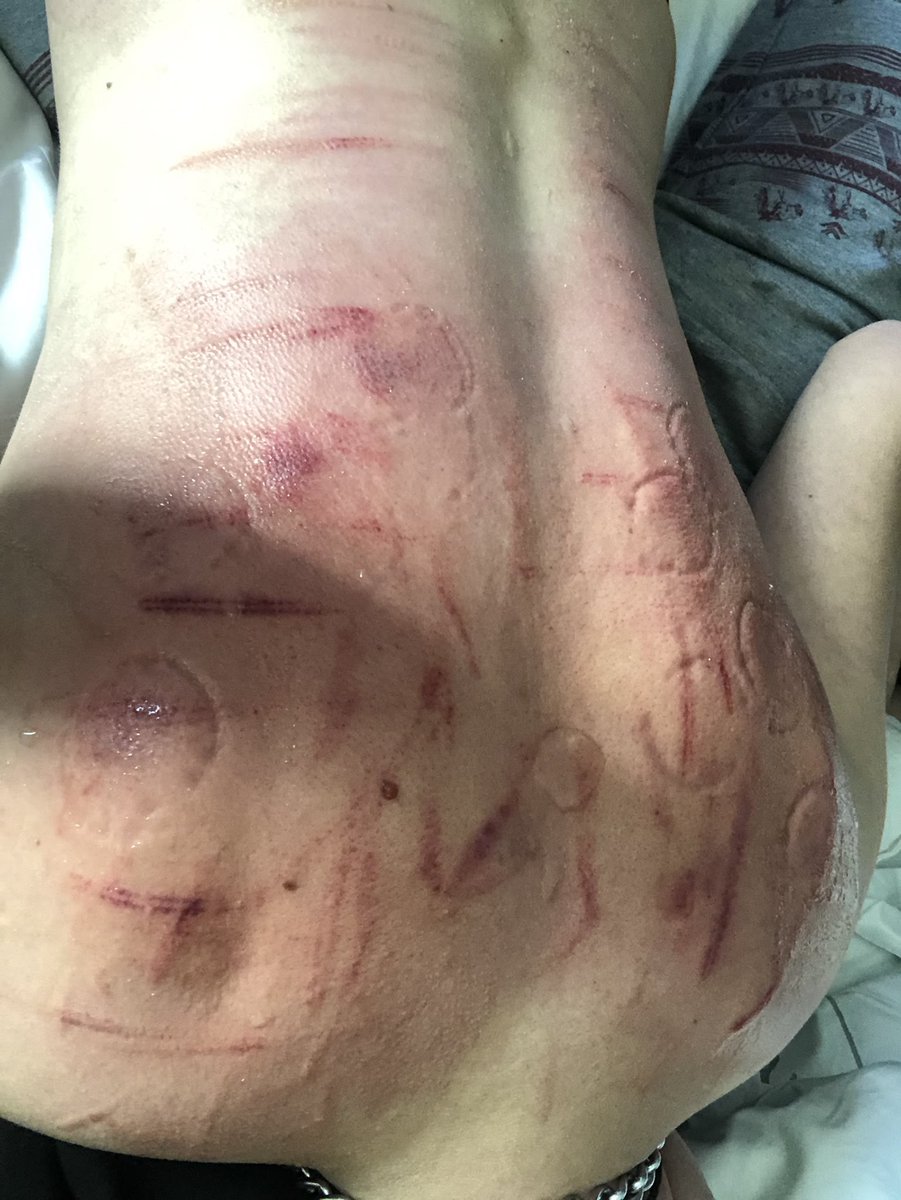 Nano 🔜 Darklands tweet media