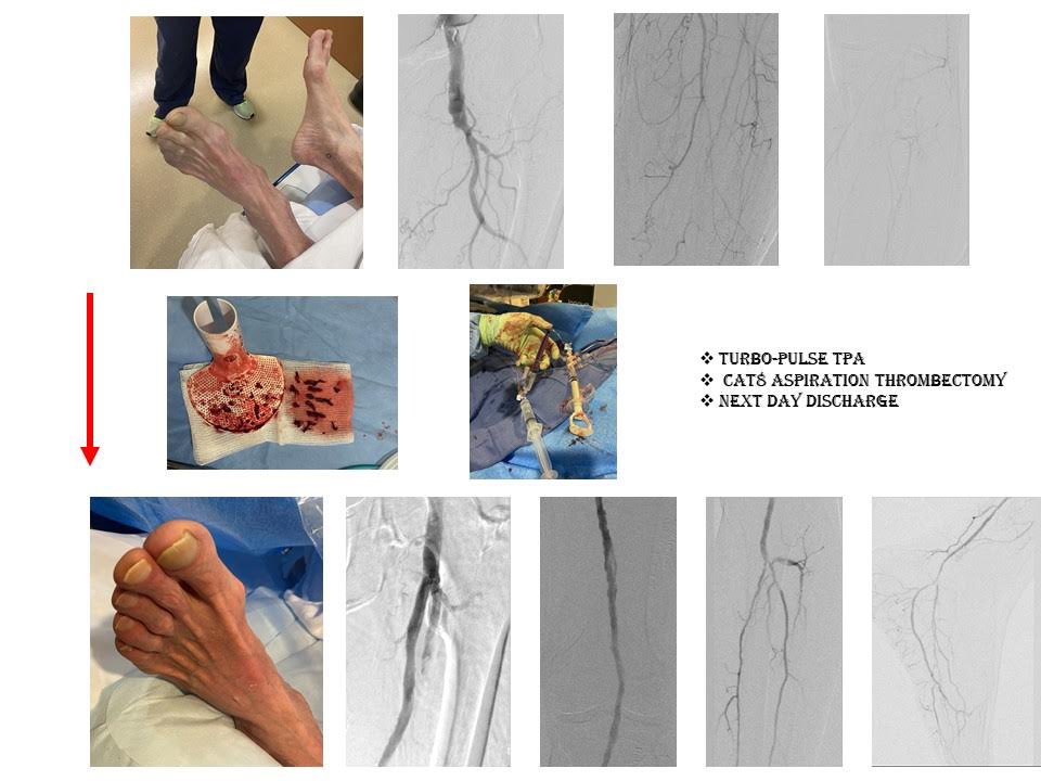 Ashkan Karimi MD, FACC, RPVI tweet media