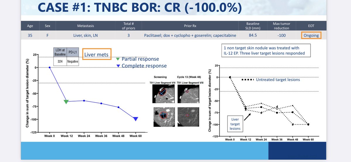 LONGADAP's tweet photo. $ONCS @OncoSec #OncoSec is also doing great work in, eg, #BreastCancer #TripleNegativeBreastCancer #TNBC
https://t.co/HW2k3RnyAz https://t.co/KP88AUdtMt