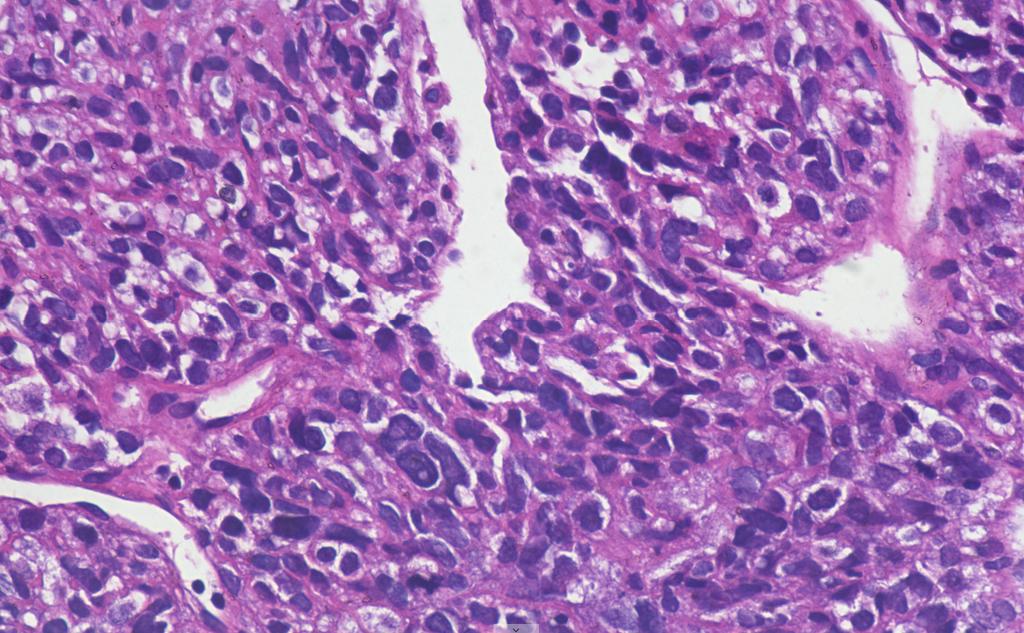 Andy_pathology tweet picture