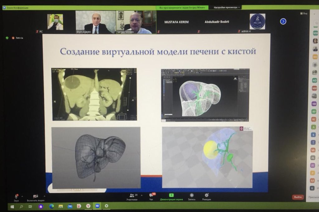 sminaev2015's tweet photo. On December 20, 2020, a Zoom conference was held dedicated to the 90th anniversary of the Azerbaijan Medical University #SoMe4Surgery #SoMe4HPB #some4 #some4pedsurg #some4precision #sminaev #eHealth #pediatricsurgery #Some4SurgeryIT1 #EduTwitter #HigherEd #some https://t.co/zWIY7FqZ2J