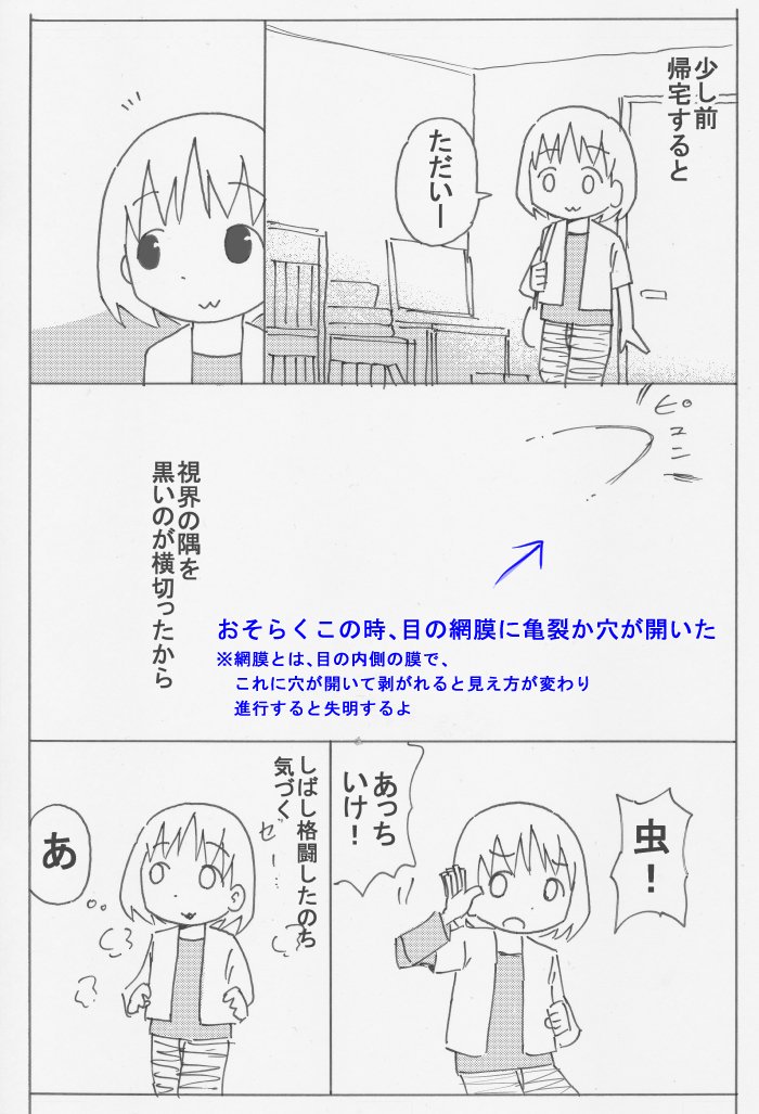 網膜剥離のやつ誤診編。漫画は誤診直後に描いて載せたやつで、青字が網膜剥離がわかった後にたした訂正文。
この時気づけば、レーザー当てるだけの日帰りで済むので、似たような症状の方は早めに病院で相談してね。 