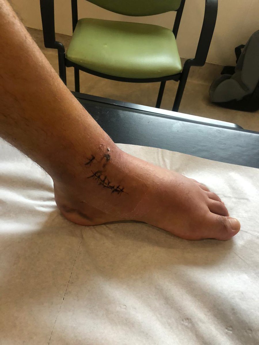 JaayCleR's tweet photo. Después de 2 semanas de reposo debido a mi operación de fractura de peroné y corte de ligamento de tobillo....volvemos a jugar y a retomar 🦾😜🎮🎮 https://t.co/MztNuvMHby