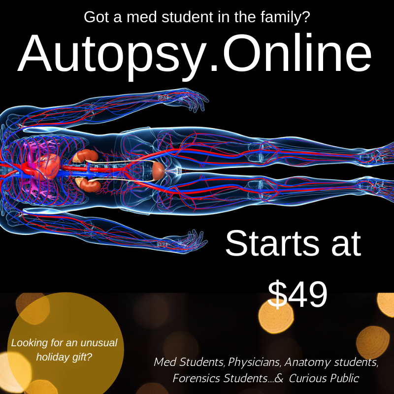 Got a #medstudent in the family?  Get them a memorable, meaningful subscription to autopsy.online.  Clinical cases explored.  Real patients in a time of distance learning.  Subscribe now.  autopsy.online/plans Starts at $49.

#autopsy #postmortem #premed  #anatomy