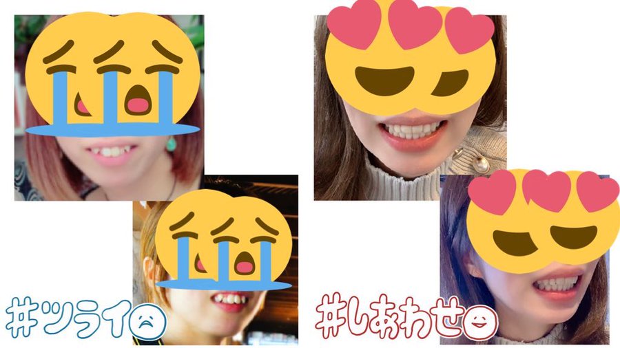 Mi Riderの素顔が美人すぎ 年齢や本名などwiki風プロフィールも めぐみとくぅちゃんのお役立ち情報