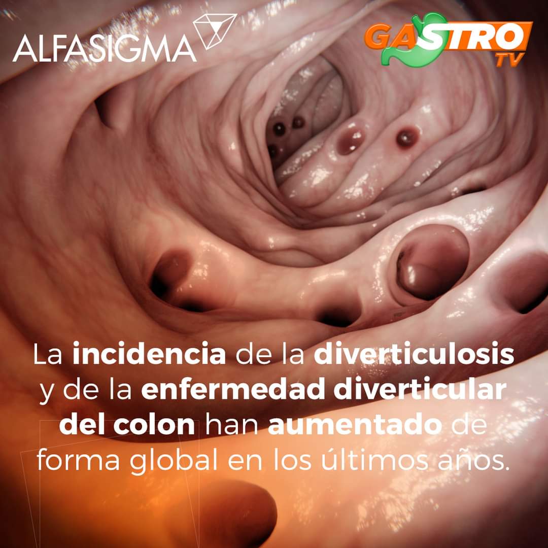 TvGastro's tweet photo. La incidencia de la diverticulosis y de la enfermedad diverticular del colon han aumentado de forma global en los últimos años. 

#Salud #GastroTV #GastroNews #Diverticulosis #Colon #Alfasigma #Probiotico  #Viviendoconcolitisulcerosa https://t.co/rdxoZ9c73o