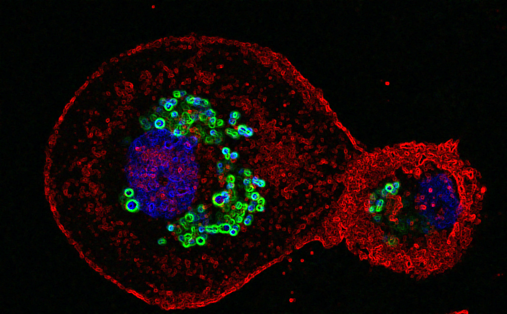 maxgabgut's tweet photo. GREAT NEWS: Happy to announce that we will have our virtual 3rd UK Cellular Microbiology Network on 1-2 March 2021 co-organised with @JennyRohn @MostowyLab @MeeraUnnikri @jasonkinglab @DHumphreysLab. Register in the link below👇👇👇
https://t.co/E3KnbBl7C2 https://t.co/VUI2GjdUIw