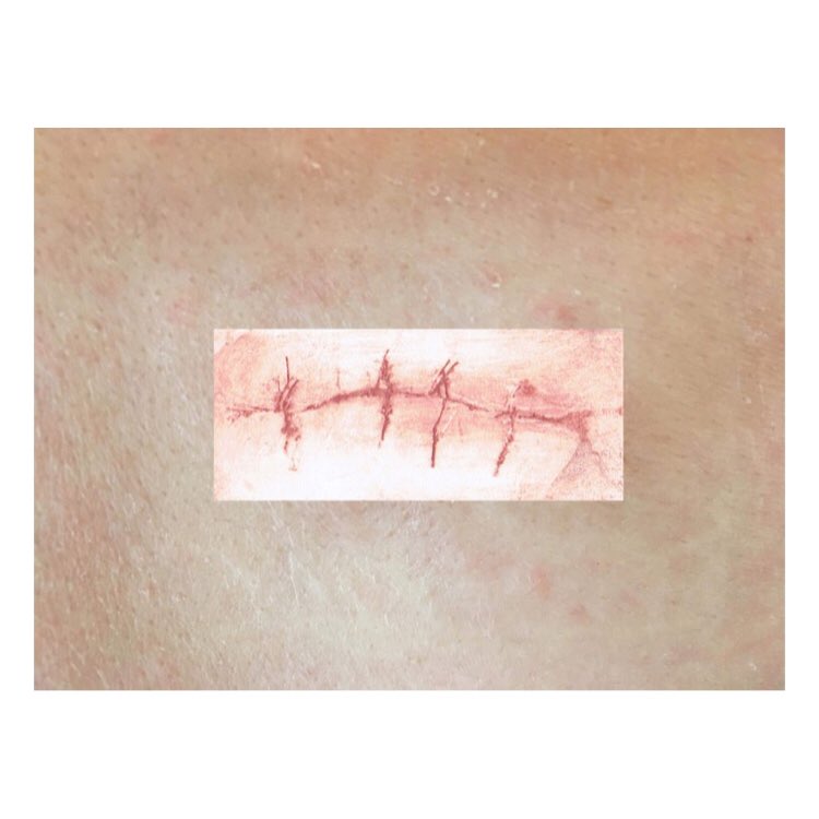 CrossStreetArts's tweet photo. Our @klairedoyleart has launched a new body of research with Georgianna Cardoso on scars, motherhood and safe spaces for female practitioners to work. They are thankful for support from @the_birley and look forward to launching exciting plans in 2021.
#creativehighlights #scars https://t.co/2QRdMOdBoz