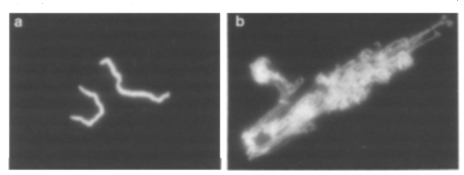 Tatsuya Hirano showed that antibody-mediated inhibition of condensin (or condensin immunodepletion) blocked chromosome thread formation in Xenopus egg extracts.11/