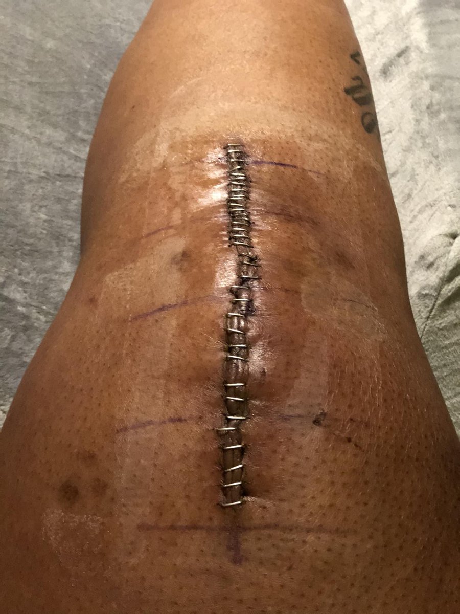 taellortaylor's tweet photo. @KimKardashian $taellortaylor 🙏🏾🙏🏾 My mom had to have knee surgery and it would help out a lot #TRIGGERWARNING #KKWHoliday #KKWHolidays https://t.co/QYHs2WfJpi