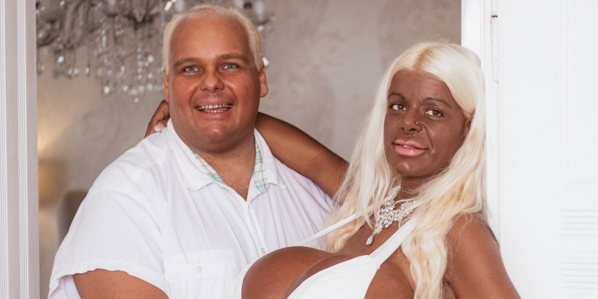 Melanin comes in different forms: solid, liquid and gas. We also know that white people have sulfur in their melanin and we have selenium in ours. Below is a couple who injected themselves with synthetic melanin.