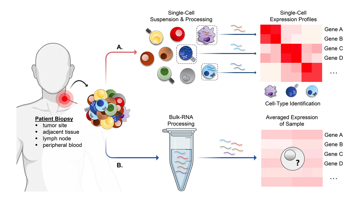 JExpMed's tweet photo. .@puneeth_guru, @MarcoRuella et al. @RuellaLab highlight recent key findings of the use of single-cell RNA sequencing to deconvolute heterogeneous tumors and immune populations during immunotherapy. https://t.co/4z7lVKusNZ
#JEMCancerFocus https://t.co/8rGwOk7bfx