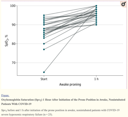 11/Aside from delivering O2 in a new way, don’t forget about PRONING! Remember V/Q mismatch? This is a non-invasive way to address that problem by having your patient lie on their belly (see pic 1).Check out the impressive results from an early publication (in pic 2)!