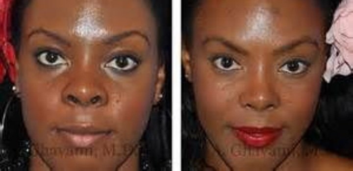 Now does this mean that every time you find a black woman with a slim nose attractive that you are participating in featurism? No that's a reach. But this needs to be addressed since it is a offspring of racism which is a offspring of white supremacy. Let's address everything.