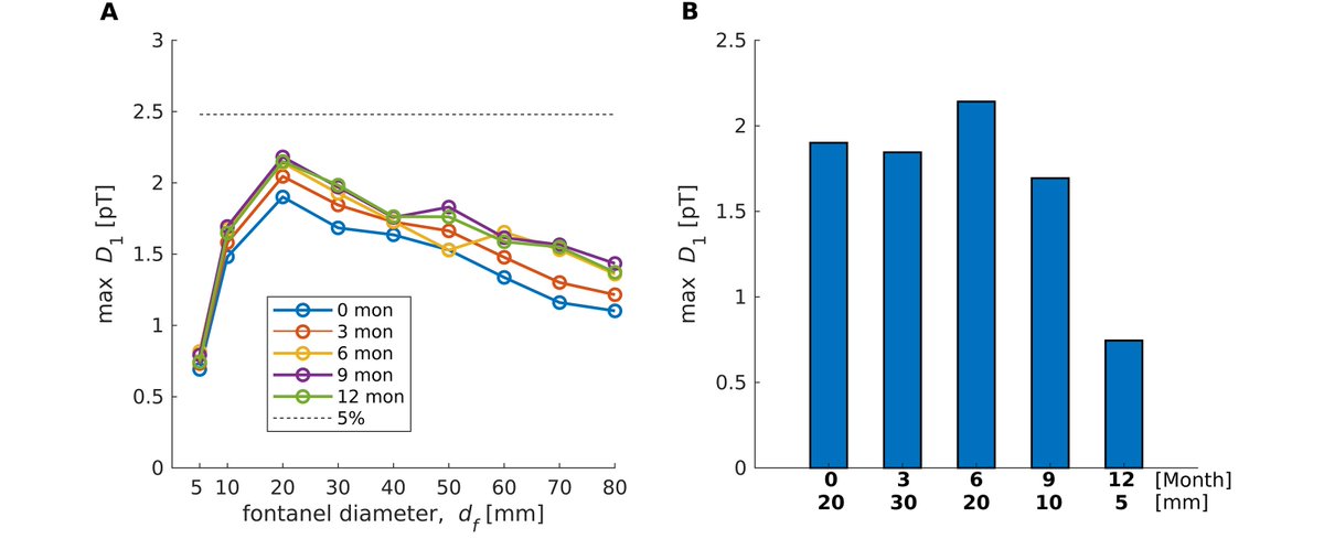 ClinicalNeuroph's tweet photo. [MEG in human infants] Lew et al.: "We evaluated alterations of MEG signals by unfused cranial bones in infants in a simulation study."

https://t.co/jxsiW0AOJs

#ClinicalNeuroph #MEG @BostonChildrens @harvardmed @MGHMartinos https://t.co/vMtyeS9sB5