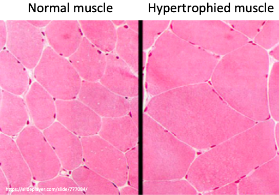 12/Satellite cell aggregates secrete actin and myosin, which get incorporated into the damaged myofibrils, repairing and expanding them.  This leads to hypertrophy and growth of muscle in the days after exercise. https://pubmed.ncbi.nlm.nih.gov/10805959/ 