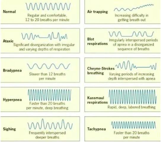 ميد  MED💉🎓 on X: Breathing Patterns 😤 Refers to the frequency of  breaths over a period of time & tidal volume It's a crucial diagnostic  criteria for a variety diseases, including