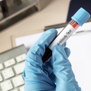 dumziee's tweet photo. Don't know if you have been exposed to COVID19, test your immunity by undergoing a COVID19 Antibody test. To know more visit us at  https://t.co/BN6BcVQDgv and call 08081111121 to book the test.

#covid19 #covid19awareness 
 #covid19vaccine #healthcare #covid #surjen #health https://t.co/RwaMEL50LQ