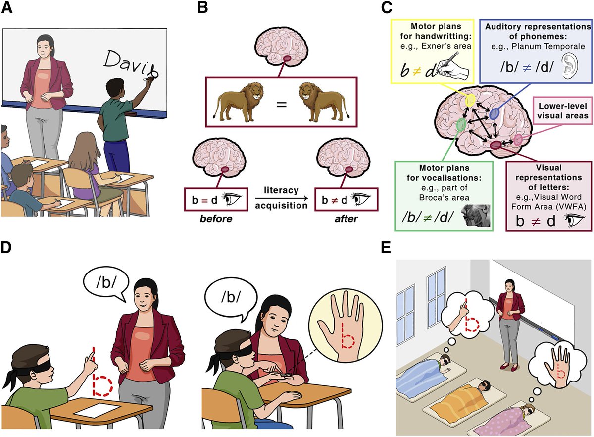 StanDehaene's tweet image. Reading acquisition: A recent study confirms that mirror confusions can be a significant hurdle in first grade, and suggests that a targeted intervention, including multisensory training and naps, can make a big difference. Sleep promotes consolidation!
sciencedirect.com/science/articl…