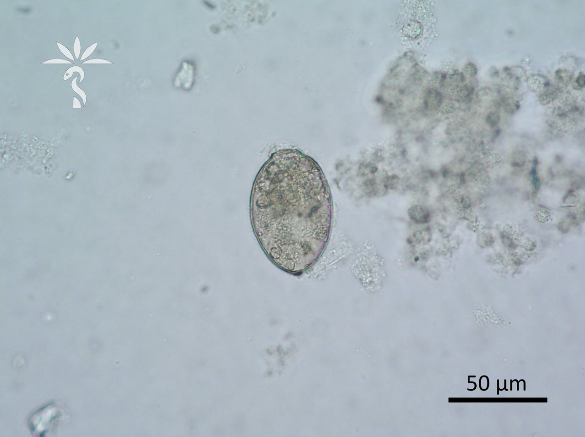 Bobbi Pritt, MD (@parasitegal) on Twitter photo The first Parasite Case of the New Year is up – and it’s a real challenge! From a neck cyst in an African man: parasitewonders.blogspot.com/2021/01/case-o…
#asmclinmicro #MayoClinMicro #mayopath #parasites #pathology <a href="/JMGardnerMD/">Jerad Gardner, MD</a> <a href="/mayocliniclabs/">Mayo Clinic Labs</a> <a href="/ASTMH/">ASTMH</a> <a href="/Pathologists/">CAPathologists</a> <a href="/AmSocParasit/">ASP-Parasitologists</a> <a href="/LSHTM/">London School of Hygiene & Tropical Medicine</a> #path2path The first Parasite Case of the New Year is up – and it’s a real challenge! From a neck cyst in an African man: parasitewonders.blogspot.com/2021/01/case-o…
#asmclinmicro #MayoClinMicro #mayopath #parasites #pathology <a href="/JMGardnerMD/">Jerad Gardner, MD</a> <a href="/mayocliniclabs/">Mayo Clinic Labs</a> <a href="/ASTMH/">ASTMH</a> <a href="/Pathologists/">CAPathologists</a> <a href="/AmSocParasit/">ASP-Parasitologists</a> <a href="/LSHTM/">London School of Hygiene & Tropical Medicine</a> #path2path