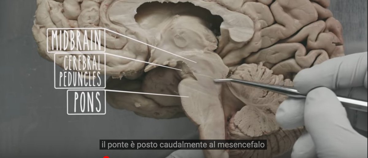 mcphoo's tweet photo. @sig_chi - and #hci peeps - want to learn anatomy and neurology to help design in new impactful ways? look out for #inbodiedinteraction 101 and 102 courses at CHI - eg - how is the brains stem (here) relevant to all interaction design including health and wellbeing? come see! https://t.co/FaoymZITLu