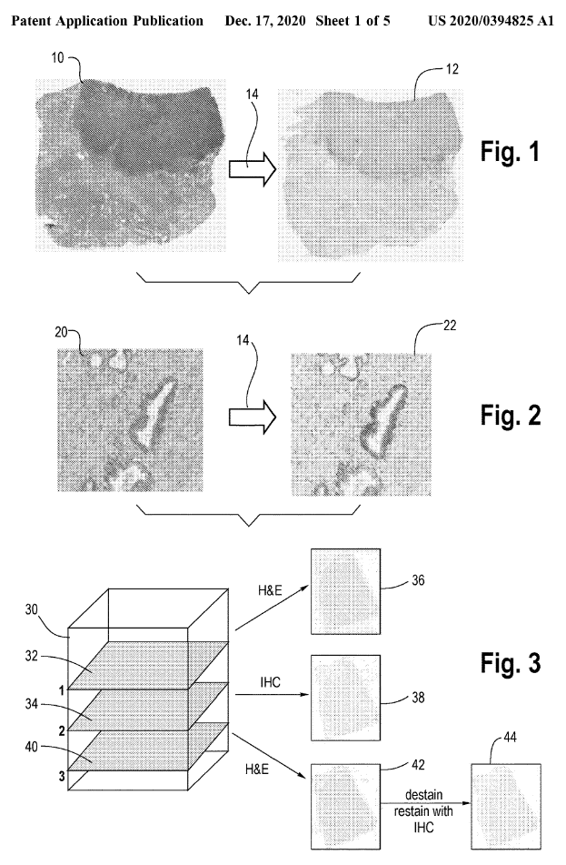 Andrew Schaumberg tweet media