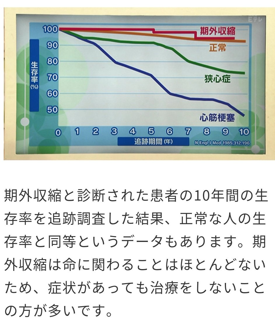 期外収縮 期外収縮