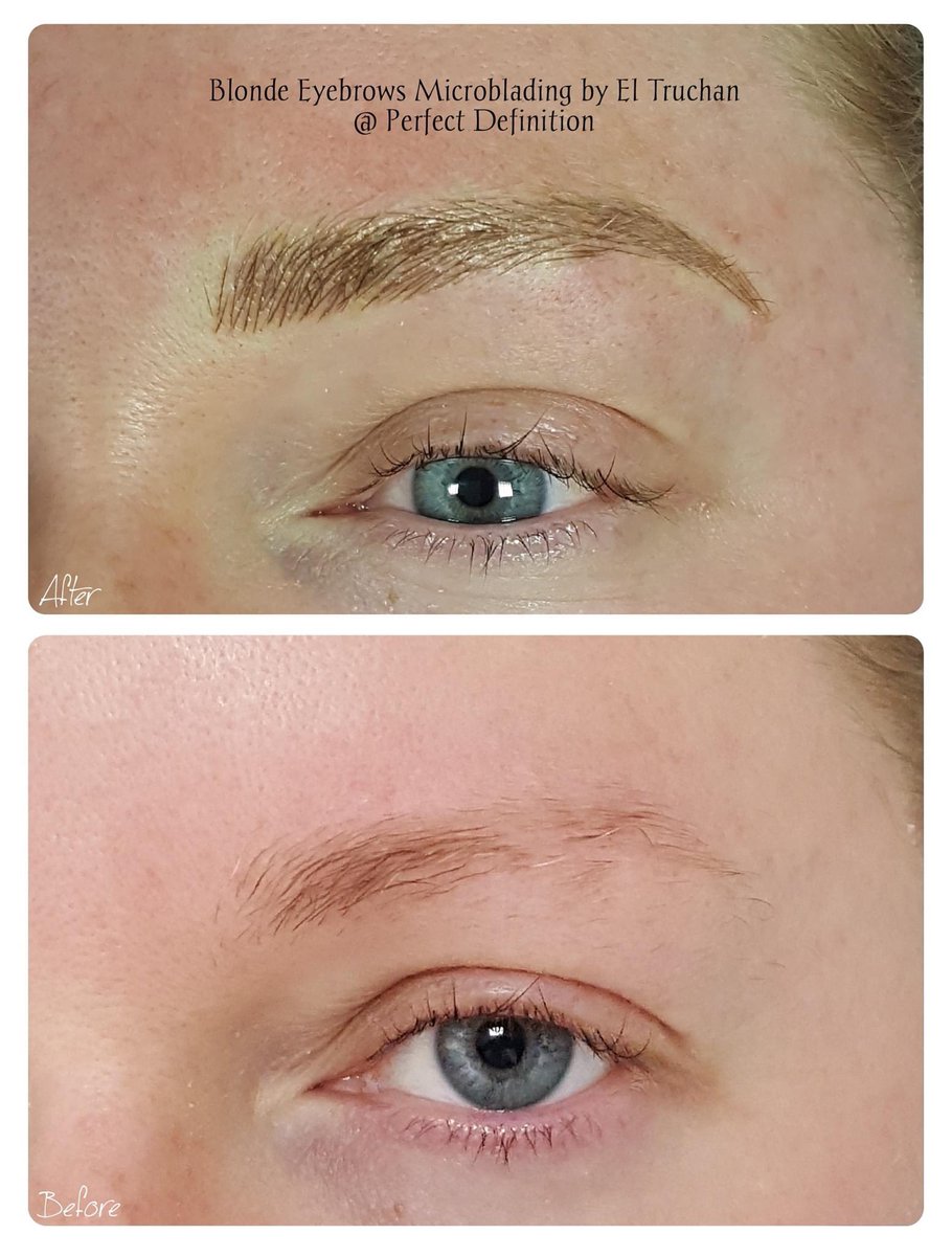 ElTruchan's tweet image. Blonde Eyebrows Microblading by El Truchan @ Perfect Definition

#combinationbrows #eyebrowssculpting #wakeupwithmakeup #digitalmicroblading #ombrebrows #permanentmakeuplondon #londondiaries #pmu #invisibrow