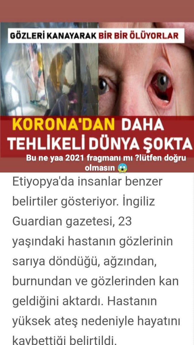 #corona #COVID19 #korona #hastalıkx adını bile yeni duyduğumuz bi hastalık mı doğuyor ? Daha çok küçük yaşların risk taşıdığı bu hastalık DSÖ tarafından 2018 tarihinde tahmin edilmişti 😱