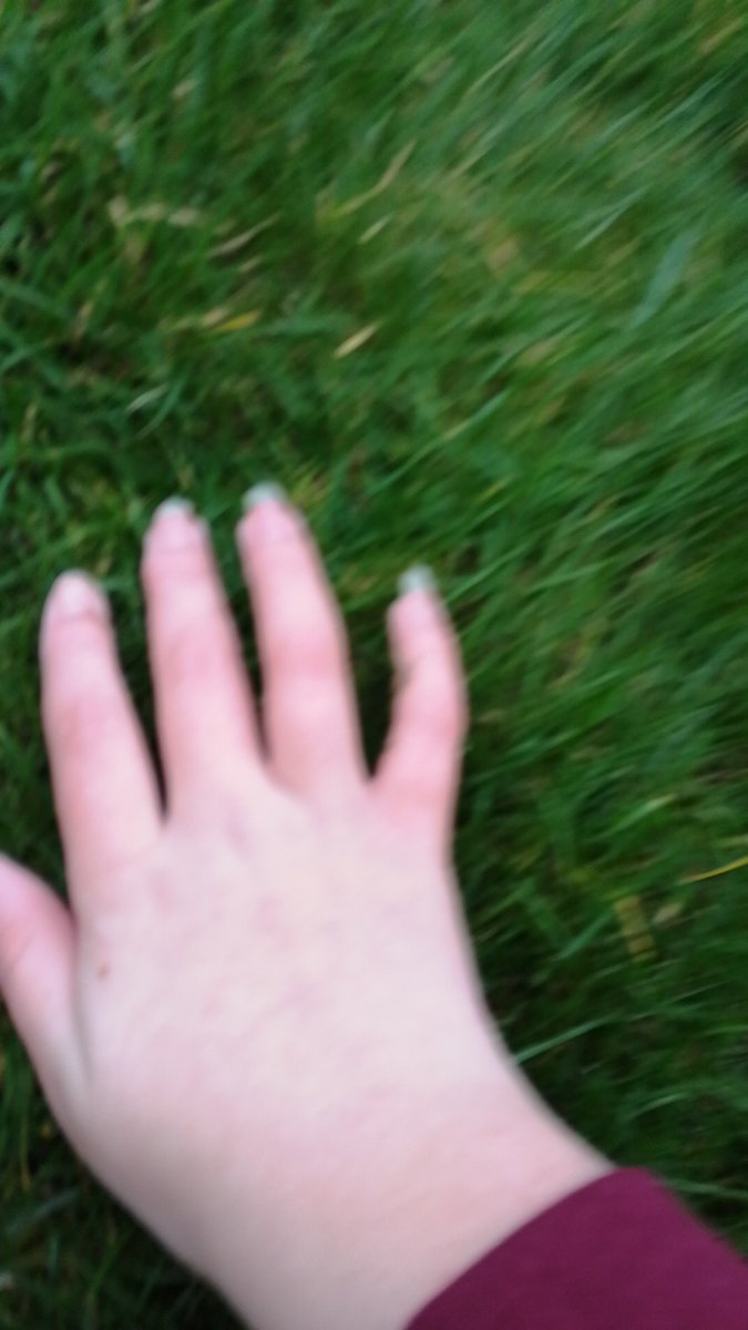 sleepy6d's tweet photo. guys i went outside!!!!!!!! omg so lovely to be in the fresh air you should go outside some time also ignore how red and pale my hands are https://t.co/eN7YGokI2A