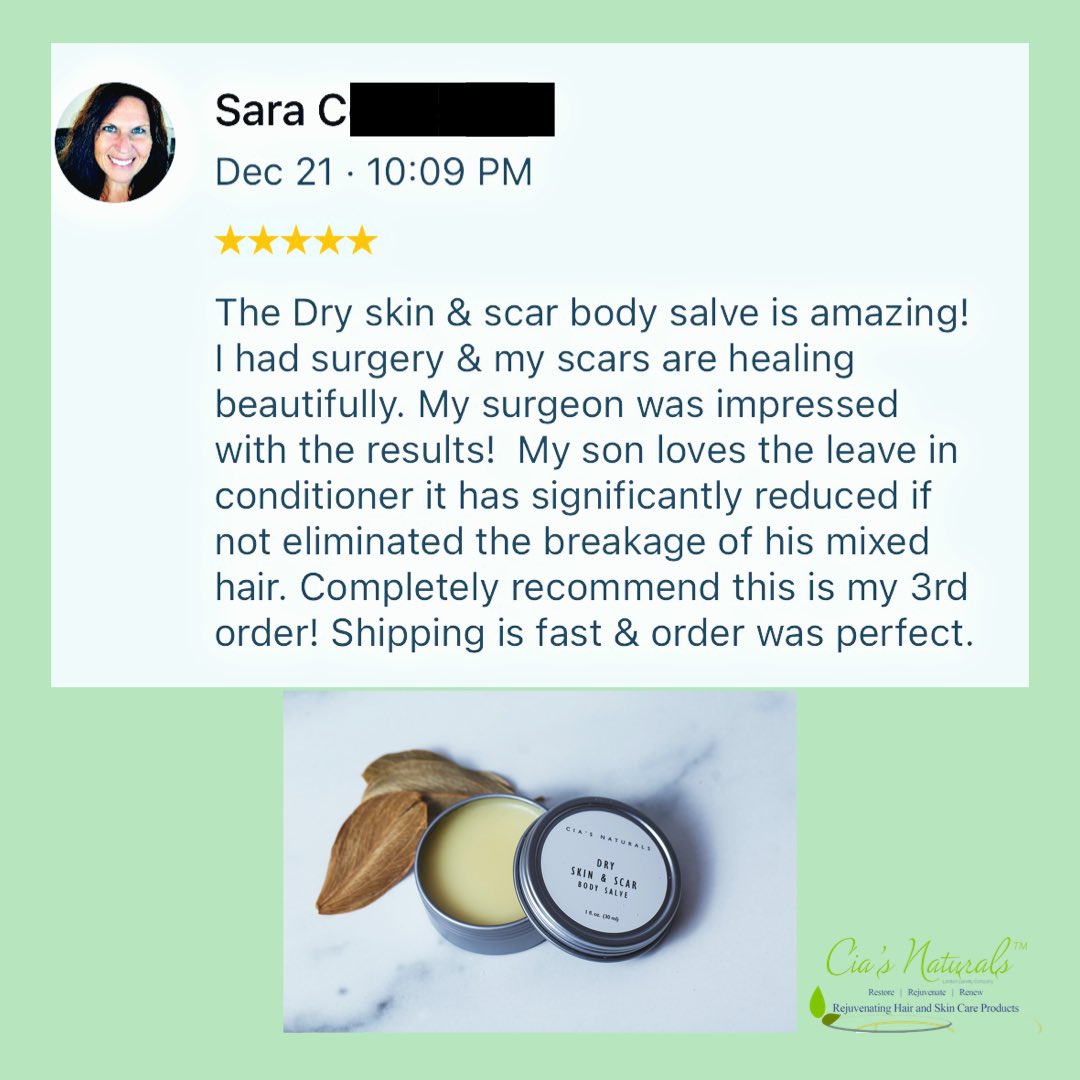 ciasnatural's tweet photo. Thank you Sara for your continuous support and for believing in our brand.

#customerappreciation #customersatisfaction #customerreviews #customerreview #customerlove #naturalskincareproducts #naturalskincare #ciasnaturals https://t.co/QNGqeNh3hd