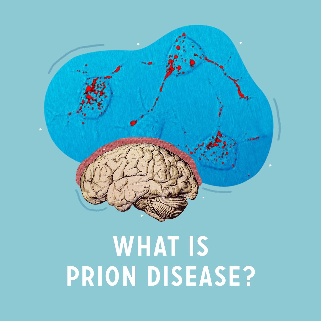 “You probably have never heard of prion diseases before. We usually think about viruses and bacteria causing us harm. In prion diseases, a family of rare neurological disorders, the damaging agent is a misfolded protein which contains no genetic information. (1/10)