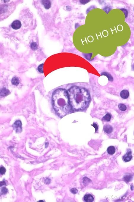 DrVaanya's tweet photo. Too cute to not be shared! π
Merry Christmas everyone πand happy holidays π₯³
(Img source-Internet)
#TisTheSeason #ToBeJolly #MerryChristmas #HappyNewYear #PathologyResident #PathArt π¬ https://t.co/A6DGvgpPR7