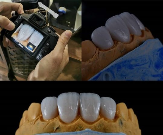 Drmohanadh's tweet photo. لنشاهد معاجمالية ابتسامة هوليود 3D بياض دائم+حيويه طبيعيه+شكل رائع
تستحقها
#ابتسامة_هوليوود #ابتسامة_بوليوود
#جمعة_مباركة #تجميل #مقاطعه_المنتجات_الفرنسيه59 #حربي_بالاجواء #كلنا_اصالة #رانيا_يوسف #القوات_الخاصة #خطة_التوازن_المالي #Bridgerton #MerryChristmas https://t.co/K5gu8qQV43