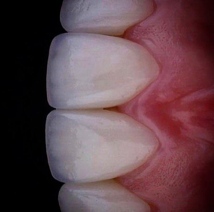 Drmohanadh's tweet photo. لنشاهد معاجمالية ابتسامة هوليود 3D بياض دائم+حيويه طبيعيه+شكل رائع
تستحقها
#ابتسامة_هوليوود #ابتسامة_بوليوود
#جمعة_مباركة #تجميل #مقاطعه_المنتجات_الفرنسيه59 #حربي_بالاجواء #كلنا_اصالة #رانيا_يوسف #القوات_الخاصة #خطة_التوازن_المالي #Bridgerton #MerryChristmas https://t.co/K5gu8qQV43