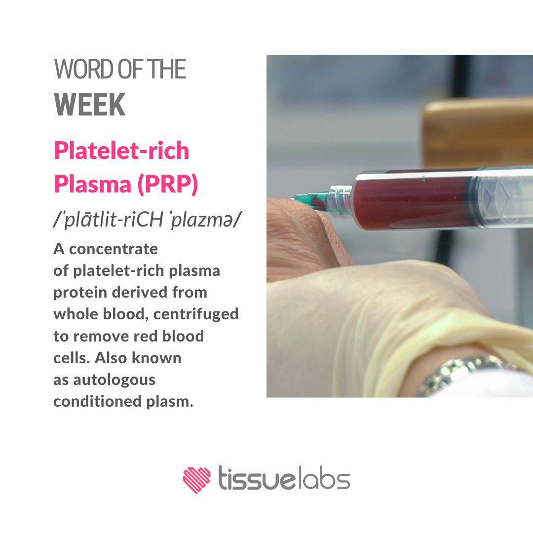 WORD OF THE WEEK:
Platelet-rich Plasma (PRP) /ˈplātlit-riCH ˈplazmə/ 
A concentrate of platelet-rich plasma protein derived from whole blood, centrifugedto remove red blood cells. Also known as autologous conditioned plasm.

#protein #prp #plasma