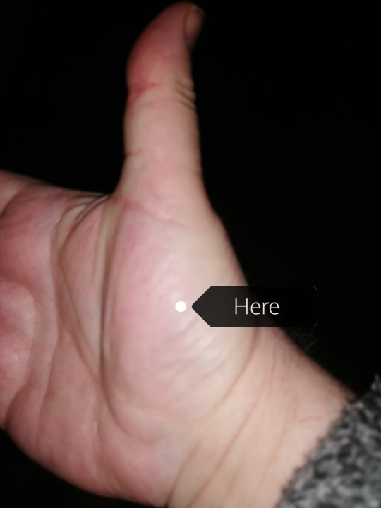 pashnguy's tweet photo. https://t.co/5JM3OQoP0U | #Covid?! |
ALSO the point central to the ball of the thumb helps. Doesnt apoear on acupuncture charts as using needle would cause injury perhaps....? https://t.co/RSvFHUP1qv