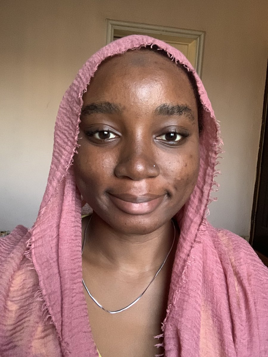 I would cry to my sister severally. I had never hated myself as much as I did. I finally found a brand that worked for me. But for a few dark spots here and there, my skin is clearer than it has ever been. I still obsess over how it's not perfect yet, but it is no longer as bad.