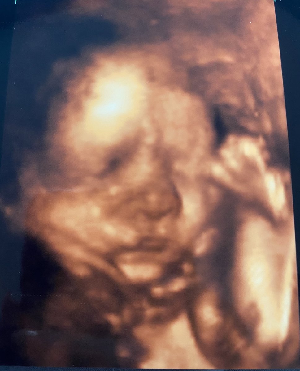 sarahbaugh14's tweet photo. my tiny baby 🥺 https://t.co/Hgco72Qsdi