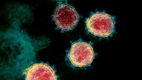CBCEdmonton's tweet photo. Alberta records estimated 900 new COVID-19 cases on Christmas Day https://t.co/U9eSgoPZeC https://t.co/ESBPPPHJAb