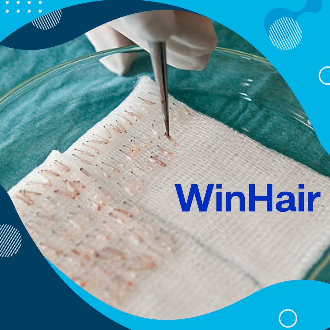 En Win Hair tenemos un excelente cuidado de tus folículos en nuestros procesos de trasplante capilar winhairs.com
#tecnicafue #transplantecapilar #transplantecabello #calviciemasculina #solucionescapilares #alopecia #bautifulhair #hairtranspant #hairtransplant